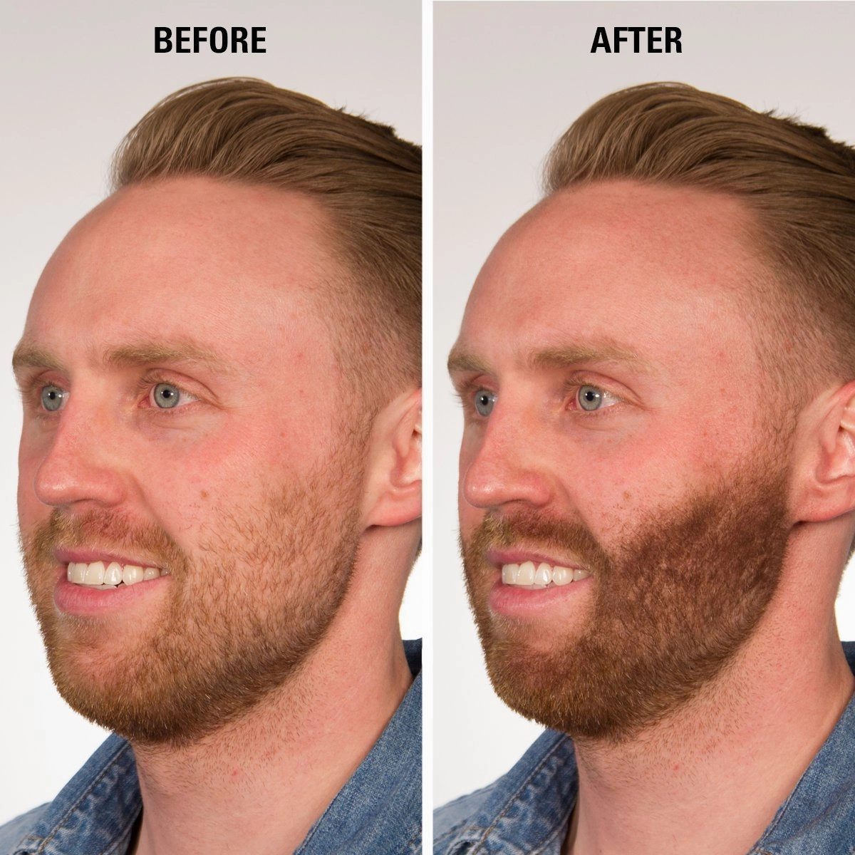 ECLIPSE Hair Fibers Auburn for Thinning Hair for Women & Men to Conceal Hair Loss in 15 Seconds - 100% Undetectable Hair Building Fibers, 15g