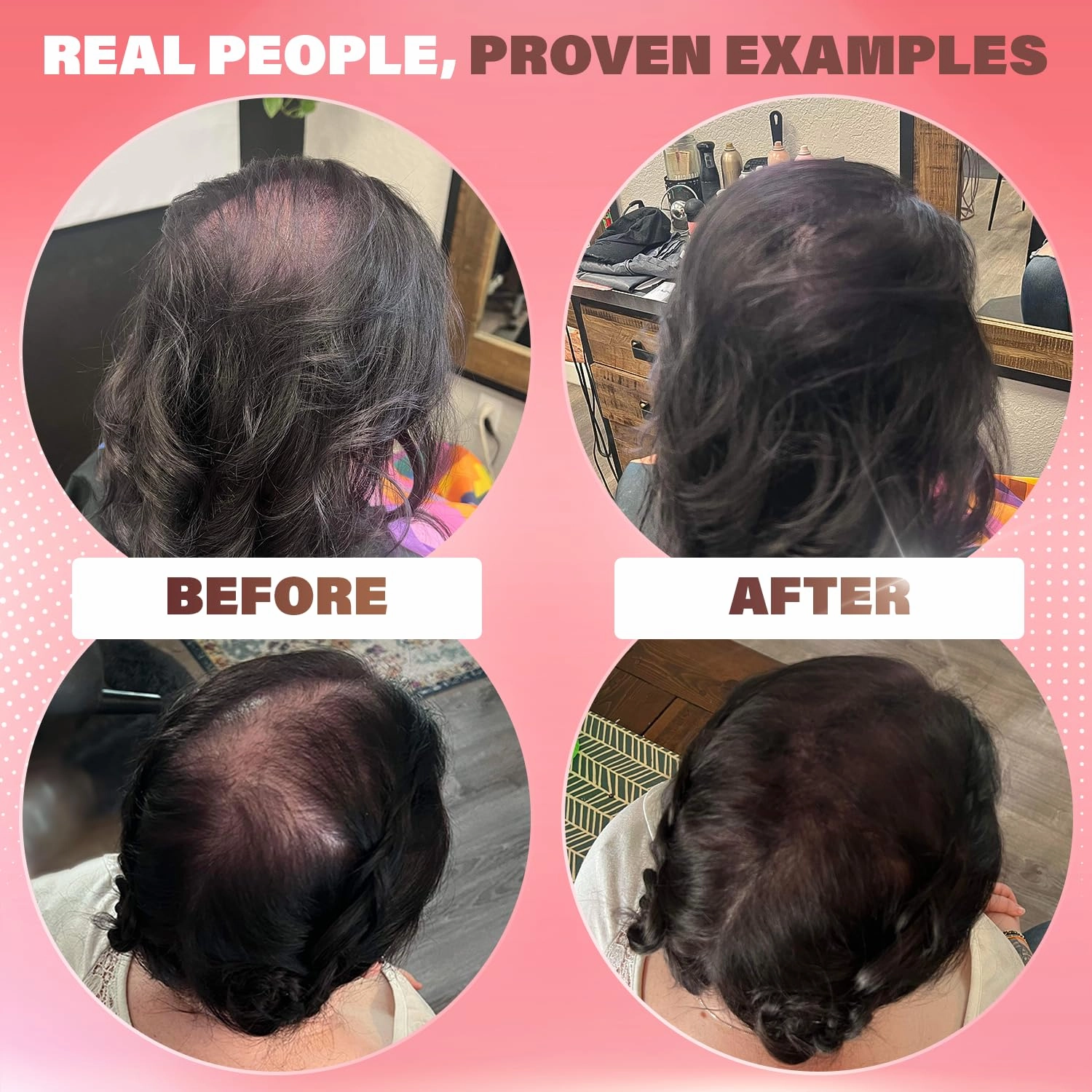 Fibers for Thinning Hair (Auburn), Undetectable Hair Powder for Women & 100% Natural Hair Building Fibers - Conceals Hair Loss - Bald Spot Cover Up Hair Powder, 2 Month Supply