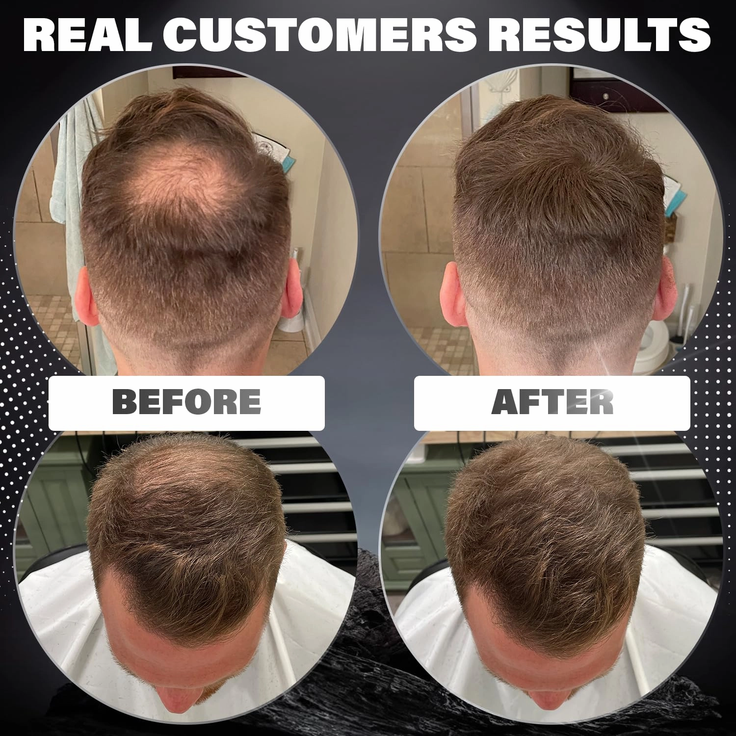Fibers for Thinning Hair (Black), Undetectable Hair Powder for Men & 100% Natural Hair Building Fibers - Conceals Hair Loss - Bald Spot Cover Up Hair Powder, 2 Month Supply