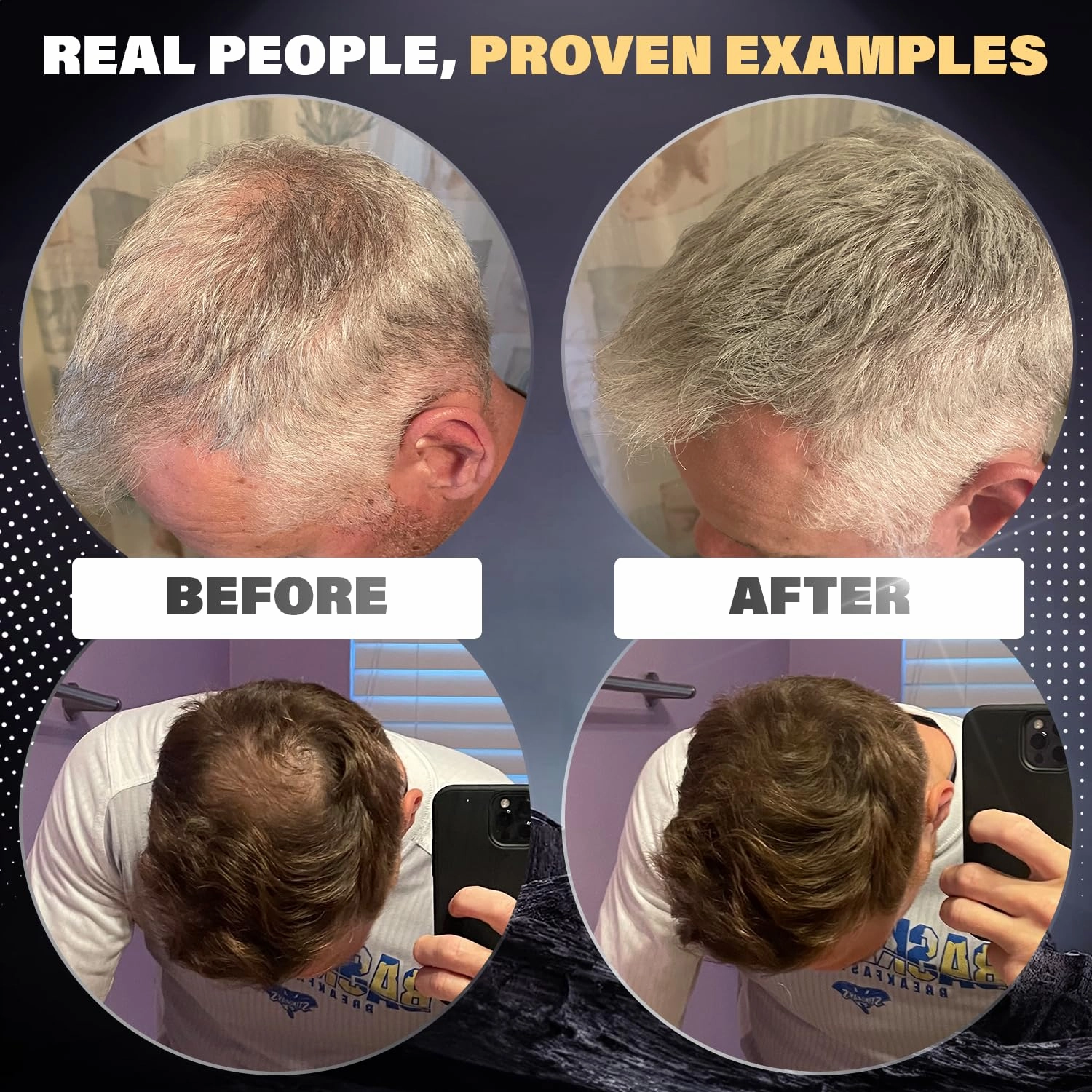 Fibers for Thinning Hair (Black), Undetectable Hair Powder for Men & 100% Natural Hair Building Fibers - Conceals Hair Loss - Bald Spot Cover Up Hair Powder, 2 Month Supply
