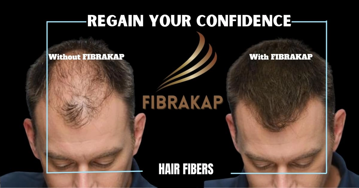 hair building fibers women and men, Conceals Hair Loss in Seconds, hair fibers composed of keratin (DARK BROWN)