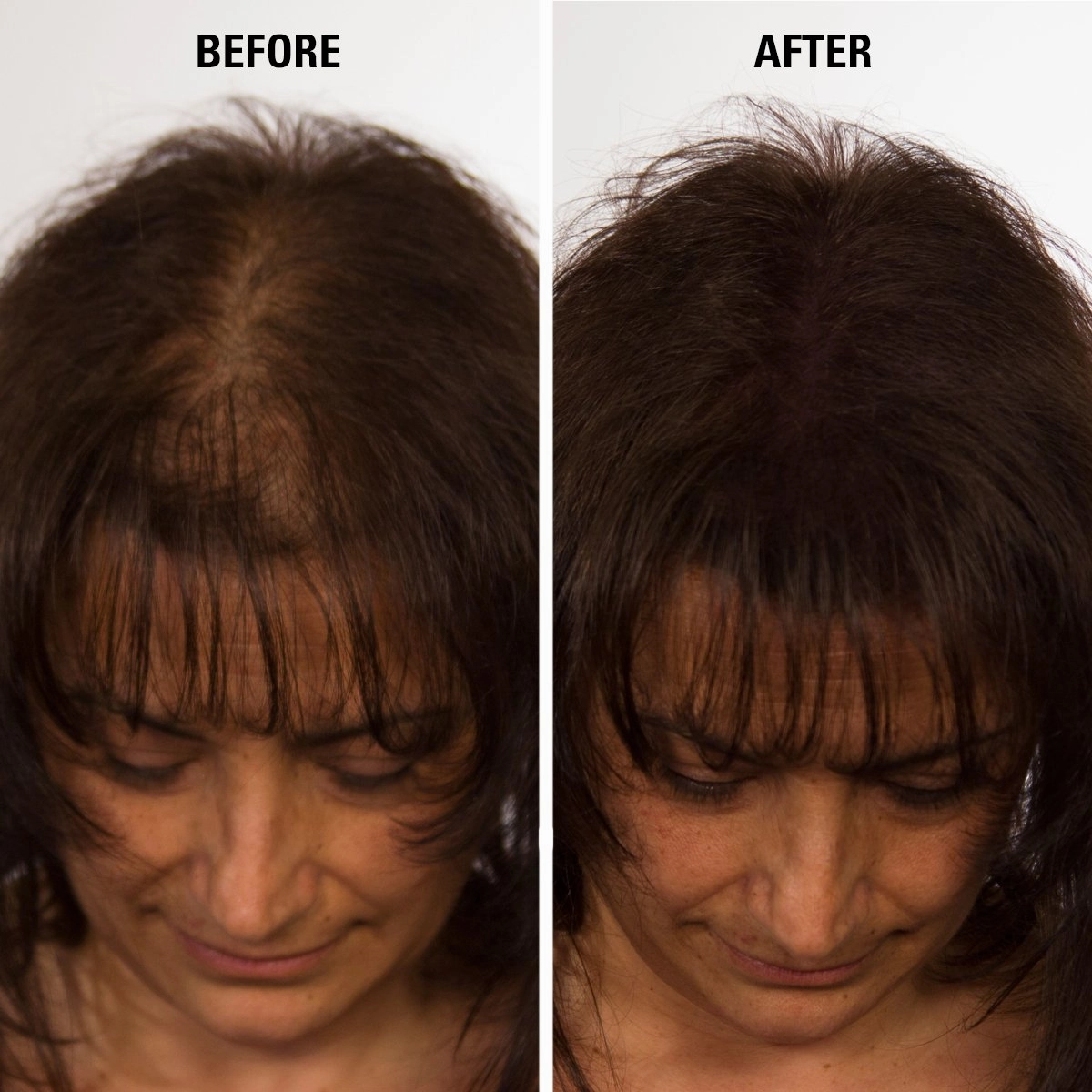 Hair Fibers Black for Thinning Hair for Women & Men - 100% Undetectable Hair Building Fiber Powder - Conceal Hair Loss in 15 Seconds, 30g